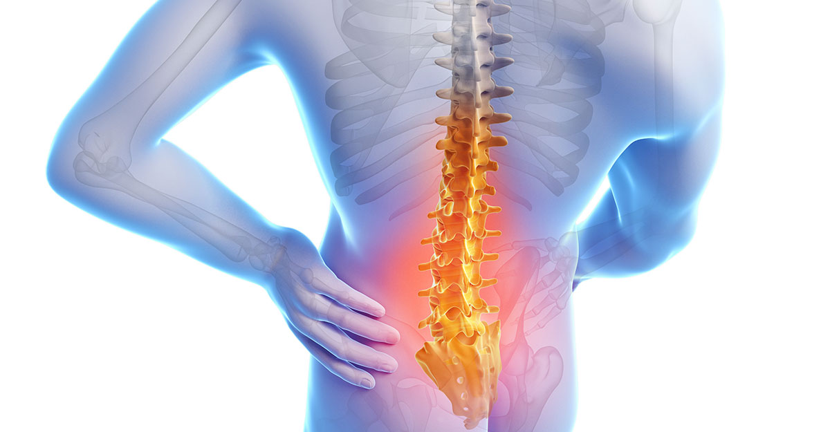 Alexandria Back Pain Treatment without Surgery