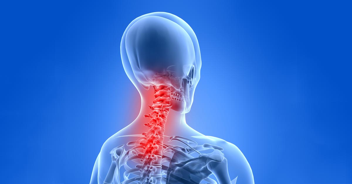 Alexandria, KY neck pain and headache treatment