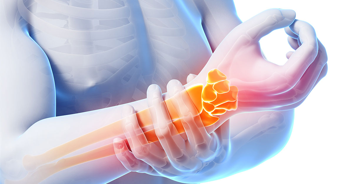 Featured image for Chiropractic Beneficial for Carpal Tunnel